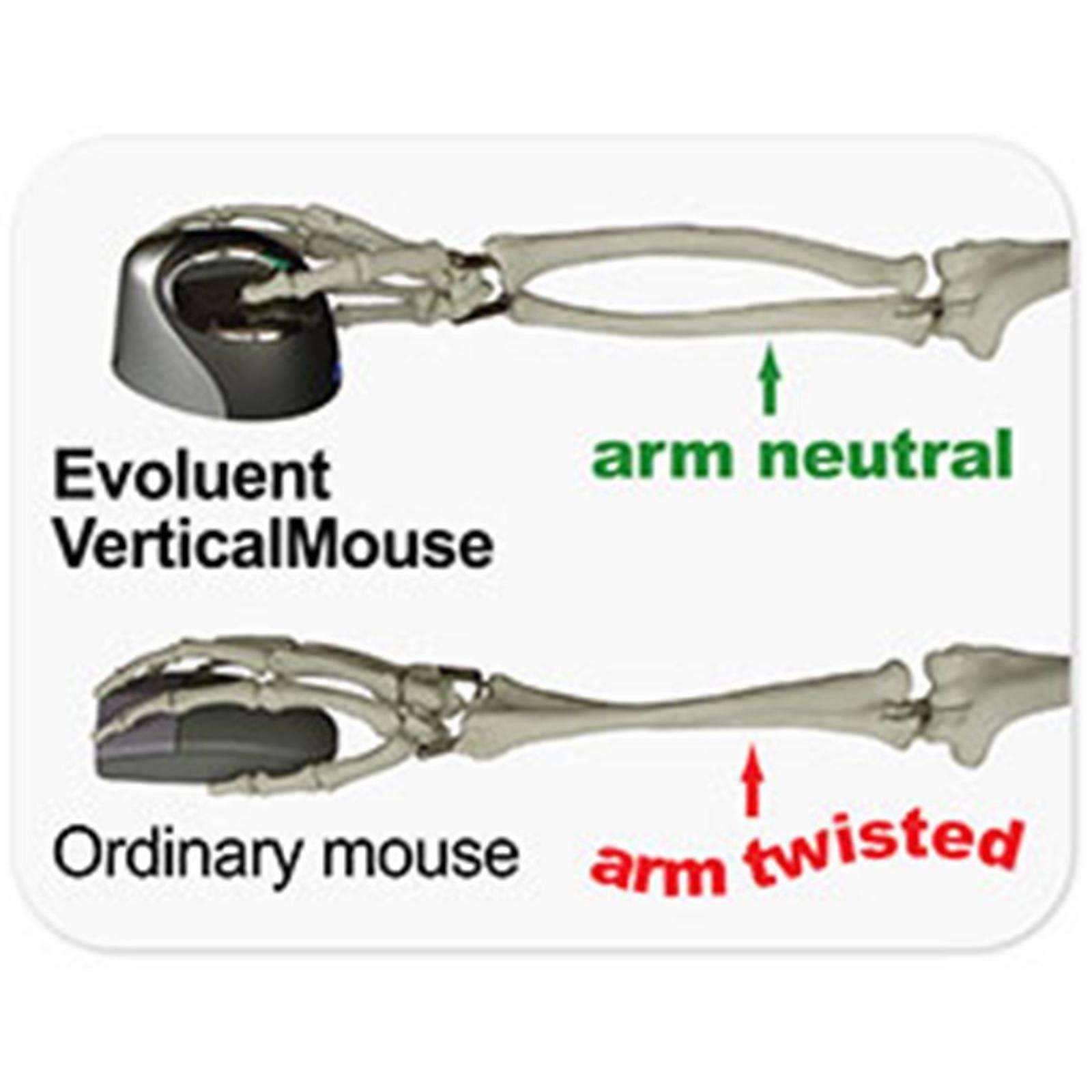 VerticalMouse 4 Right Bluetooth W388